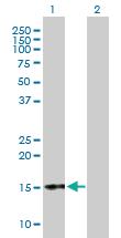 Anti-CGA Rabbit Polyclonal Antibody