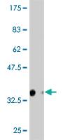 Anti-LBX1 Mouse Monoclonal Antibody [clone: 3G6]