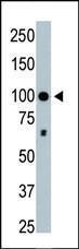 Anti-HDAC4 Rabbit Polyclonal Antibody (AP (Alkaline Phosphatase))