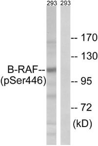 Western blot analysis of lysates from 293 cells treated with EGF 200ng/ml 30' using Anti-B-RAF (phospho Ser446) Antibody. The right hand lane represents a negative control, where the antibody is blocked by the immunising peptide.