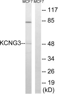 Western blot analysis of lysates from MCF-7 cells using Anti-KCNG3 Antibody. The right hand lane represents a negative control, where the antibody is blocked by the immunising peptide