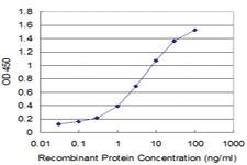 Anti-PLP1 Mouse Monoclonal Antibody [clone: 2D7]