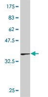 Anti-LBX1 Mouse Monoclonal Antibody [clone: 1B9]