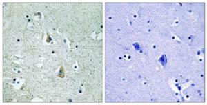 Immunohistochemical analysis of paraffin-embedded human brain using Anti-B-RAF (phospho Ser446) Antibody. The right hand panel represents a negative control, where the antibody was pre-incubated with the immunising peptide.