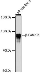 Western blot analysis of extracts of Mouse brain, using Anti-beta Catenin Antibody [ARC0136] (A307069) at 1:1,000 dilution. The secondary antibody was Goat Anti-Rabbit IgG H&L Antibody (HRP) at 1:10,000 dilution.