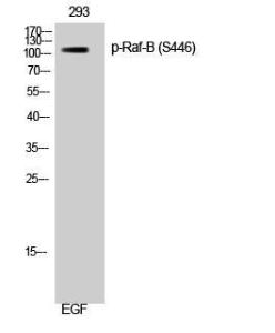 Western blot analysis of 293 cells using Anti-B-RAF (phospho Ser446) Antibody