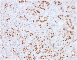 Immunohistochemical analysis of formalin-fixed, paraffin-embedded human pancreas tissue using Anti-SOX9 Antibody [SOX9/2104]