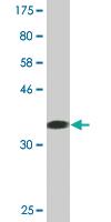 Anti-PAFAH1B1 Mouse Monoclonal Antibody [clone: 5A5]