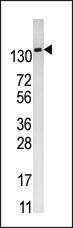 Anti-PFKFB2 Rabbit Polyclonal Antibody (FITC (Fluorescein))