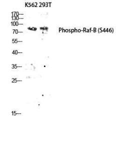 Western blot analysis of K562 293T lysis using Anti-B-RAF (phospho Ser446) Antibody