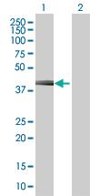 Anti-CFHR1 Mouse Polyclonal Antibody