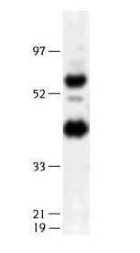 Anti-Ethenoadenosine Mouse Monoclonal Antibody (HRP (Horseradish Peroxidase)) [clone: 1G4]