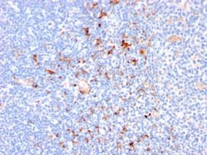 Immunohistochemical analysis of formalin-fixed, paraffin-embedded human tonsil using Anti-CD163 Antibody [M130/2164]