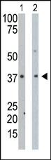 Anti-PDXK Rabbit Polyclonal Antibody