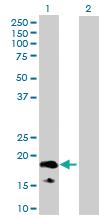 Anti-CGB Rabbit Polyclonal Antibody