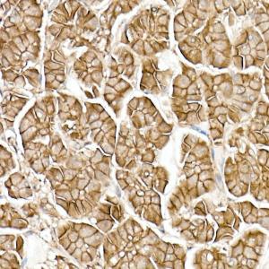 Immunohistochemistry analysis of paraffin-embedded human pancreas using Anti-beta Catenin Antibody [ARC0136] (A307069) at a dilution of 1:50(40x lens). Perform high pressure antigen retrieval with 10 mM citrate buffer pH 6.0 before commencing with IHC staining protocol.