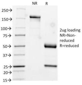 SDS-PAGE analysis of Anti-Cytokeratin 17 Antibody [KRT17/778] under non-reduced and reduced conditions; showing intact IgG and intact heavy and light chains, respectively. SDS-PAGE analysis confirms the integrity and purity of the antibody