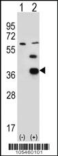 Anti-PDXK Rabbit Polyclonal Antibody