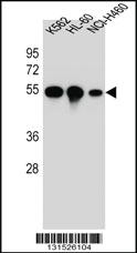 Anti-YI016 Rabbit Polyclonal Antibody