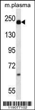 Anti-A2M Rabbit Polyclonal Antibody (APC (Allophycocyanin))