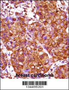 Anti-IRX3 Rabbit Polyclonal Antibody (HRP (Horseradish Peroxidase))