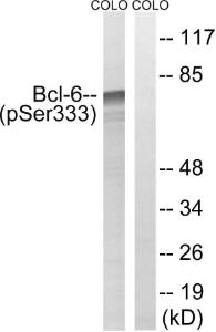 Western blot analysis of lysates from COLO205 cells treated with insulin 001U/ml 15' using Anti-Bcl-6 (phospho Ser333) Antibody The right hand lane represents a negative control, where the antibody is blocked by the immunising peptide