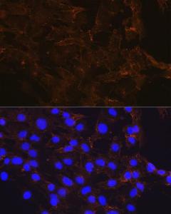 Immunofluorescence analysis of C6 using Anti-beta Catenin Antibody [ARC0136] (A307069) at dilution of 100 (40x lens). DAPI was used to stain the cell nuclei (blue).