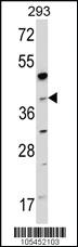 Anti-NAGK Rabbit Polyclonal Antibody