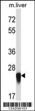 Anti-IL27 Rabbit Polyclonal Antibody (AP (Alkaline Phosphatase))