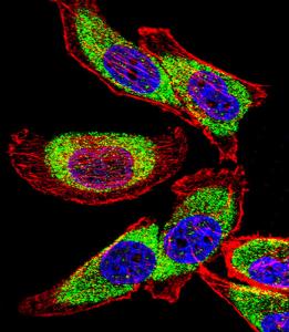 Anti-YBX1 Rabbit Polyclonal Antibody