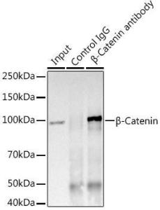 Immunoprecipitation analysis of 600µg extracts of mouse brain using 3µg of Anti-beta Catenin Antibody [ARC0136] (A307069). This Western blot was performed on the immunoprecipitate using Anti-beta Catenin Antibody [ARC0136] (A307069) at a dilution of 1:1000.