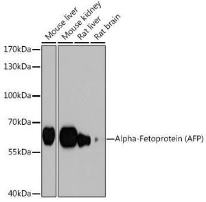 Western blot analysis of extracts of various cell lines, using Anti-alpha 1 Fetoprotein Antibody (A12534) at 1:1,000 dilution