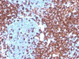 Immunohistochemical analysis of formalin-fixed, paraffin-embedded human lymph node using Anti-CD4 Antibody [CD4/3619R]