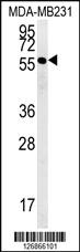 Anti-RAB11FIP2 Rabbit Polyclonal Antibody