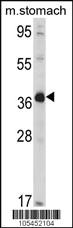 Anti-NAGK Rabbit Polyclonal Antibody