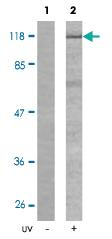 Anti-VAV1 Rabbit Polyclonal Antibody