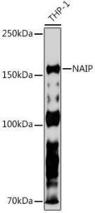 Anti-NAIP Rabbit Monoclonal Antibody [clone: ARC2258]