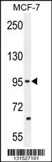 Anti-PCDH20 Rabbit Polyclonal Antibody