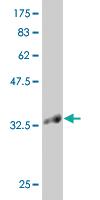 Anti-KLF1 Mouse Monoclonal Antibody [clone: 5G12]