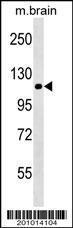 Anti-NLRP12 Mouse Monoclonal Antibody (HRP (Horseradish Peroxidase)) [clone: 228CT4.1.3]