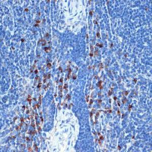 Anti-NAIP Rabbit Monoclonal Antibody [clone: ARC2258]