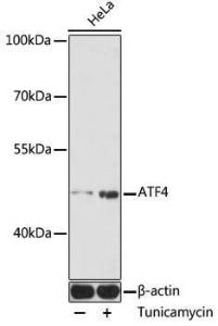 Western blot analysis of extracts of HeLa cells, using Anti-ATF-4 Antibody (A12535) at 1:1,000 dilution