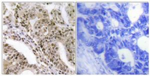 Anti-TBC1D4 Rabbit Polyclonal Antibody