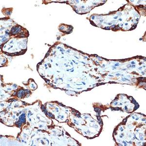 Anti-NAIP Rabbit Monoclonal Antibody [clone: ARC2258]