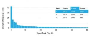 Analysis of protein array containing more than 19000 full-length human proteins using Anti-Cytokeratin 15 Antibody [KRT15/2957]