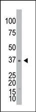 Anti-VEGFC Mouse Monoclonal Antibody