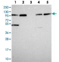 Anti-FAM160B1 Rabbit Polyclonal Antibody