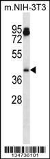 Anti-AURKA Rabbit Polyclonal Antibody (PE (Phycoerythrin))