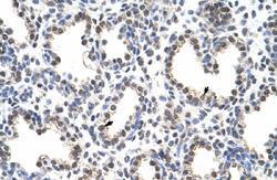 Anti-FLJ12529 Rabbit Polyclonal Antibody