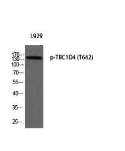 Anti-TBC1D4 Rabbit Polyclonal Antibody